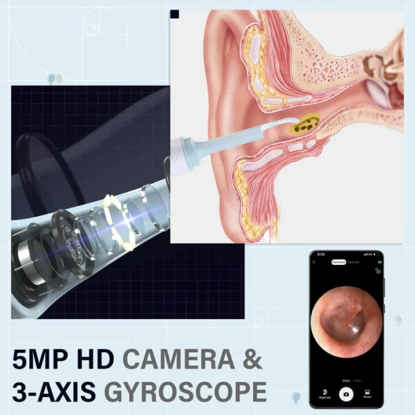 Visual Smart Ear Cleaner - Image 5